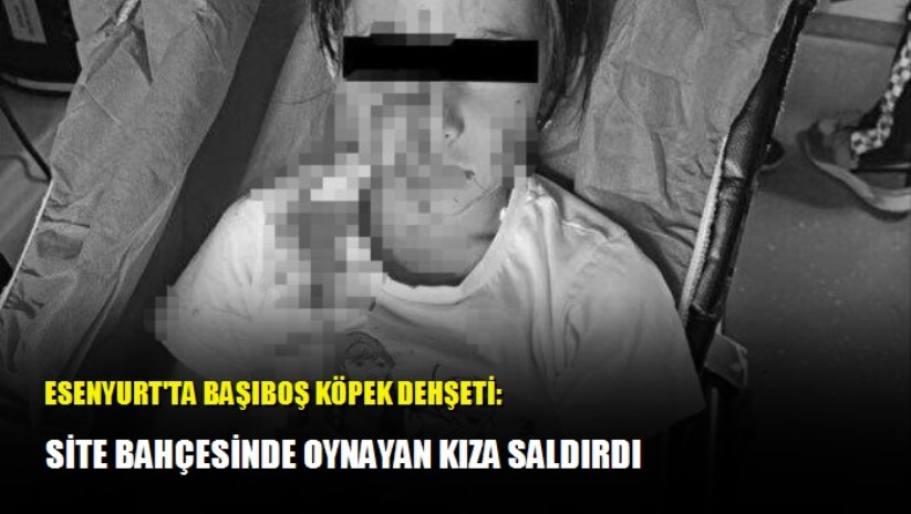 Esenyurt'ta başıboş köpek dehşeti: Site bahçesinde oynayan kıza saldırdı