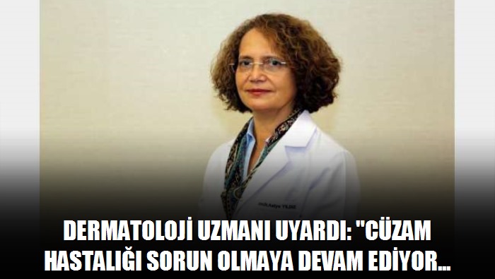 Dermatoloji uzmanı uyardı: Cüzam hastalığı sorun olmaya devam ediyor
